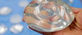 Какие бывают имплантанты груди