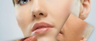 Как ухаживать за поверхностью кожи после Фракселя