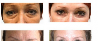 Массаж лица против морщин: эффективные техники и упражнения для занятий дома