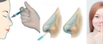 Как улучшить внешний вид с помощью ринопластики