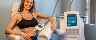 Криолиполиз на аппарате «Zeltiq»