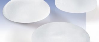 Грудные импланты «Ментор» – 4 главных преимущества