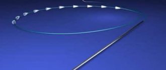 Нитевой лифтинг – в чем секрет популярности такой подтяжки кожи