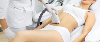 Энзимная эпиляция