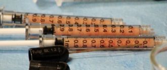 Липофилинг лица: пересадка собственного жира под глаза и в носогубные сладки + цена