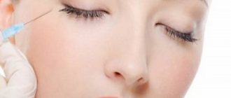 Мезотерапия вокруг глаз: преимущества и побочные эффекты + отзывы