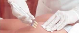 Мезотерапия для похудения: цена на препараты вполне доступна