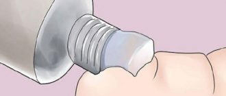 Мази от папиллом и бородавок: обзор препаратов