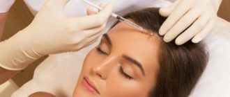 Мезотерапия для волос