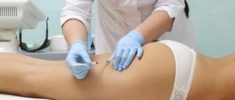 Липолиз и липолитики для борьбы с лишним жиром