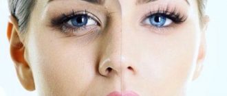 Карбокситерапия