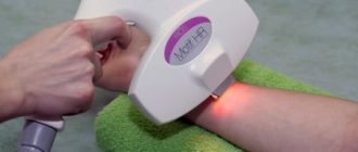 Элос эпиляция: противопоказания и результаты аппаратного удаления волос