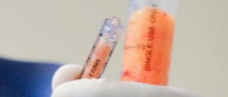 Липофилинг верхних и нижних век - безопасная альтернатива блефаропластике