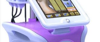 Лазерная липосакция лица как альтернатива традиционному удалению жировых отложений