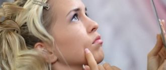 Как удалить папилломы в домашних условиях: способы и аптечные средства