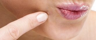 Может ли папиллома пройти сама?