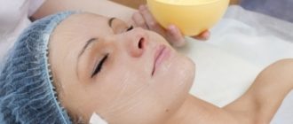 Пилинг Джесснера и его отличия от других видов пилинга