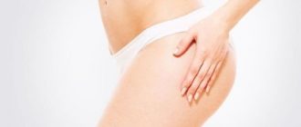 Подтяжка бедер – мнение специалистов