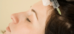 Мезотерапия для волос: проведение процедуры в клинике и в домашних условиях, противопоказания, коктейли