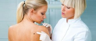 Виды, классификация и методы лечения кожных новообразований