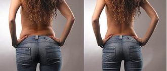 Мезотерапия тела: что это и почему препараты для мезотерапии улучшают самочувствие + видео