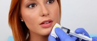 Увеличение губ гелем: выбор оптимального наполнителя