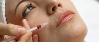 Уколы красоты: сколько стоят радиесс и можно ли делать в домашних условиях + фото и видео