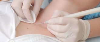 Что можно и нельзя делать после удаления папиллом: уход и возможные осложнения