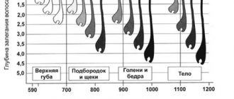 Электроэпиляция на лице и теле: фото и видео до и после + противопоказания и цены
