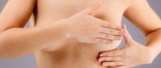 Внутрипротоковая папиллома молочной железы: причины появления и лечение