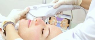 Альтера Систем – лифтинг без операции