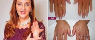 Омоложение с помощью собственных запасов – ударим жиром по старости