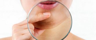 Что необходимо знать о липосакции в зоне подбородка