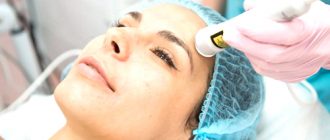 Лазерная биоревитализация