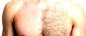 Мужская депиляция